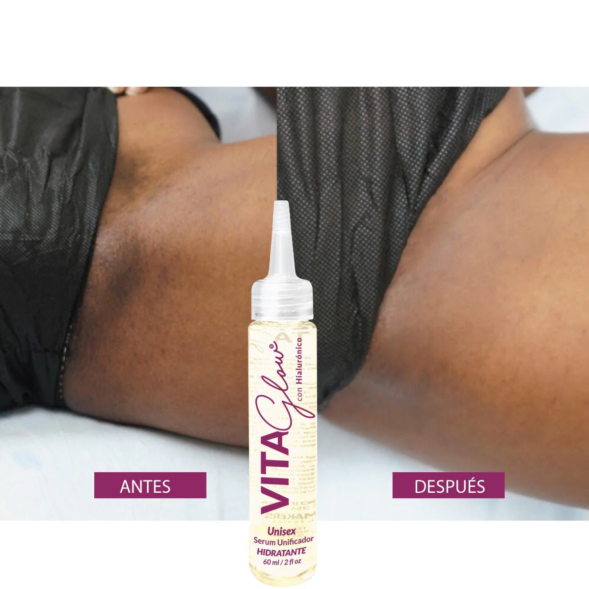 VITAGLOW® SÉRUM ACLARANTE - Nova Oficial -