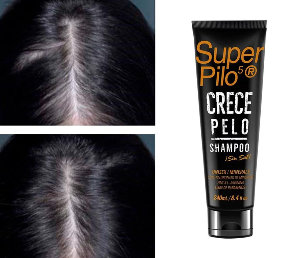 Cuero cabelludo antes y después, junto al tubo del shampoo – Superpilo shampoo crecepelo | Nova Oficial