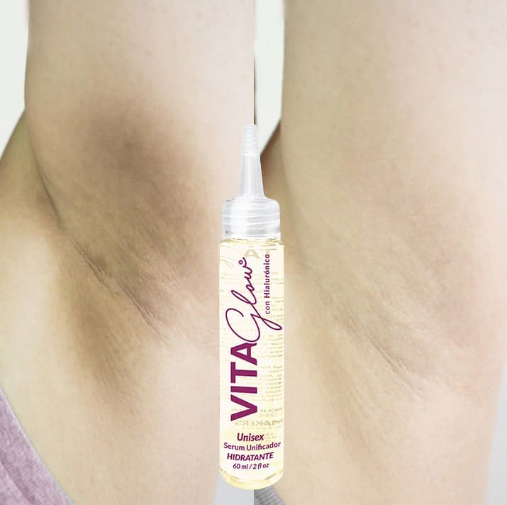 Frasco del sérum sobre una axila con zonas oscuras – VitaGlow sérum aclarante | Nova Oficial