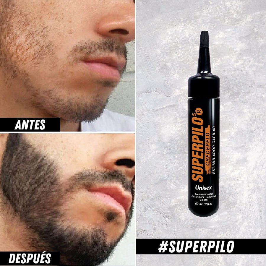 Barba antes y después del uso del tónico, junto al frasco – Superpilo tónico crecepelo | Nova Oficial